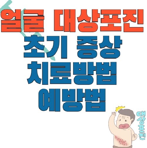 대상포진